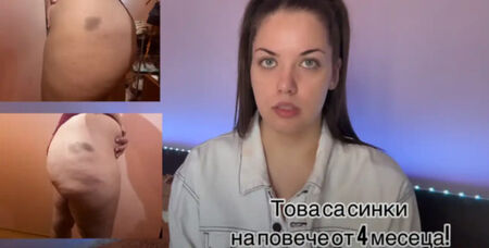 Оперира се в Турция и жестоко съжалява